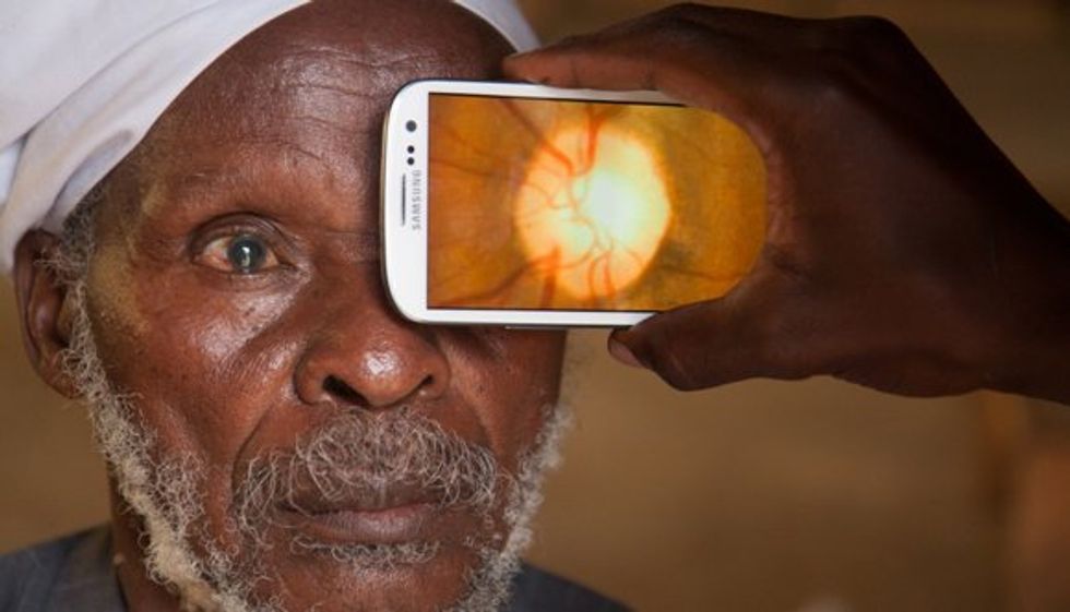 Mobile Eye Exam Promises Cheap Diagnoses for the Developing World Big