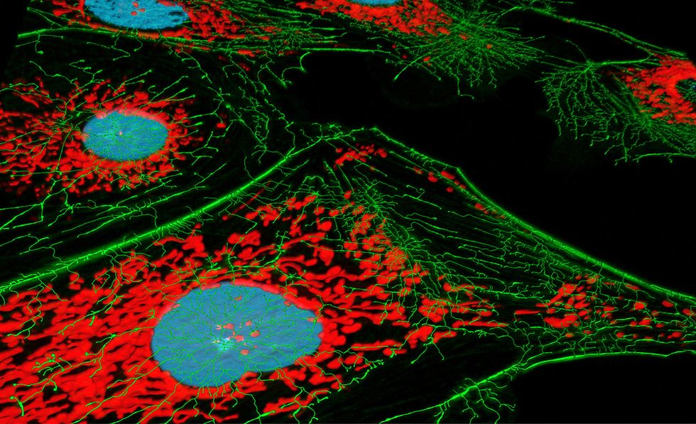 Normal Adult Cells Reprogrammed Into Stem Cells