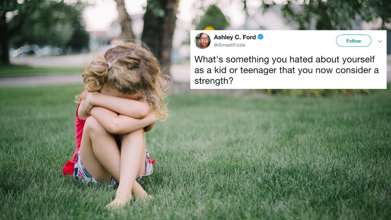 People Are Sharing The Things They Hated About Themselves As Kids That Now Give Them Strength ❤️