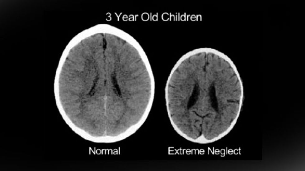 Is This the Most Misleading Image in Neuroscience?