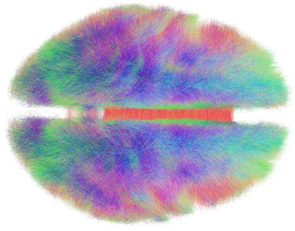 Image of the human connectome.
