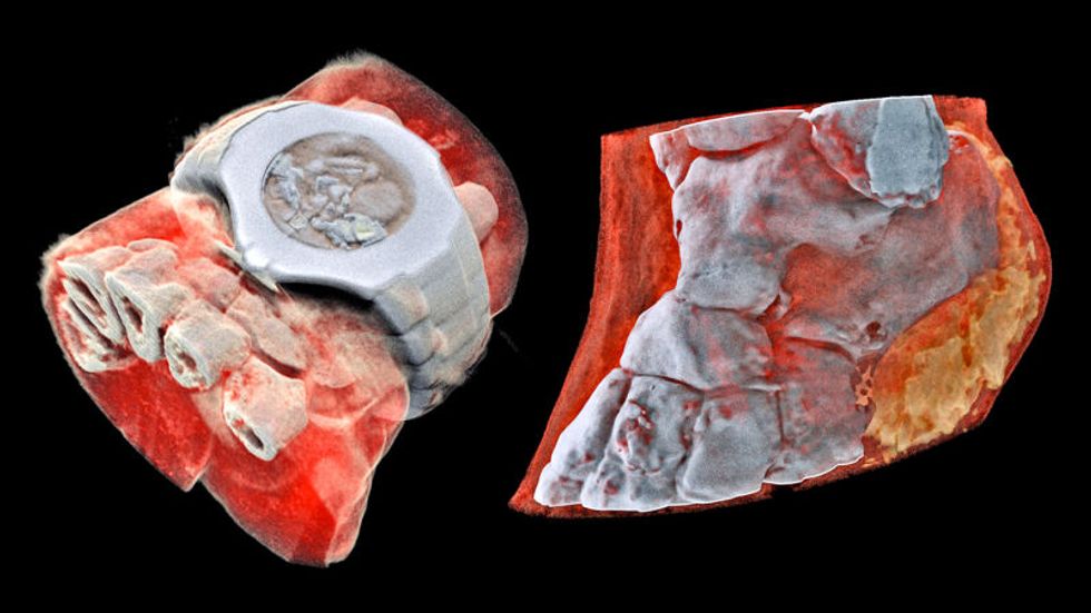Credit: MARS Bioimaging