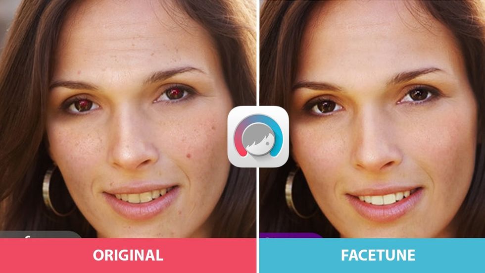  snapchat dysmorphia is fueling plastic surgery based on filtered selfies big think