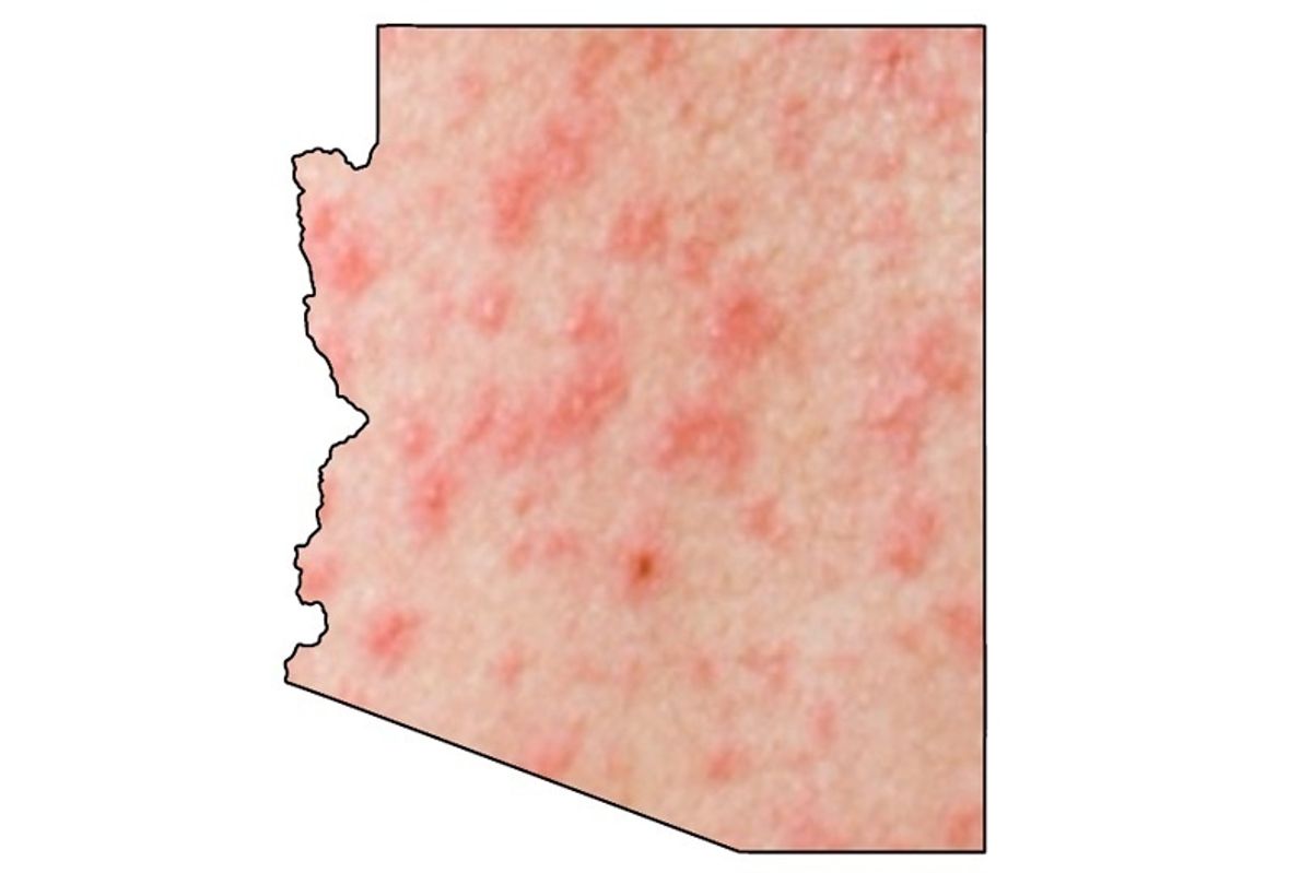 Arizona Vaccine Education Program Dead Of Stupid People, Also Polio