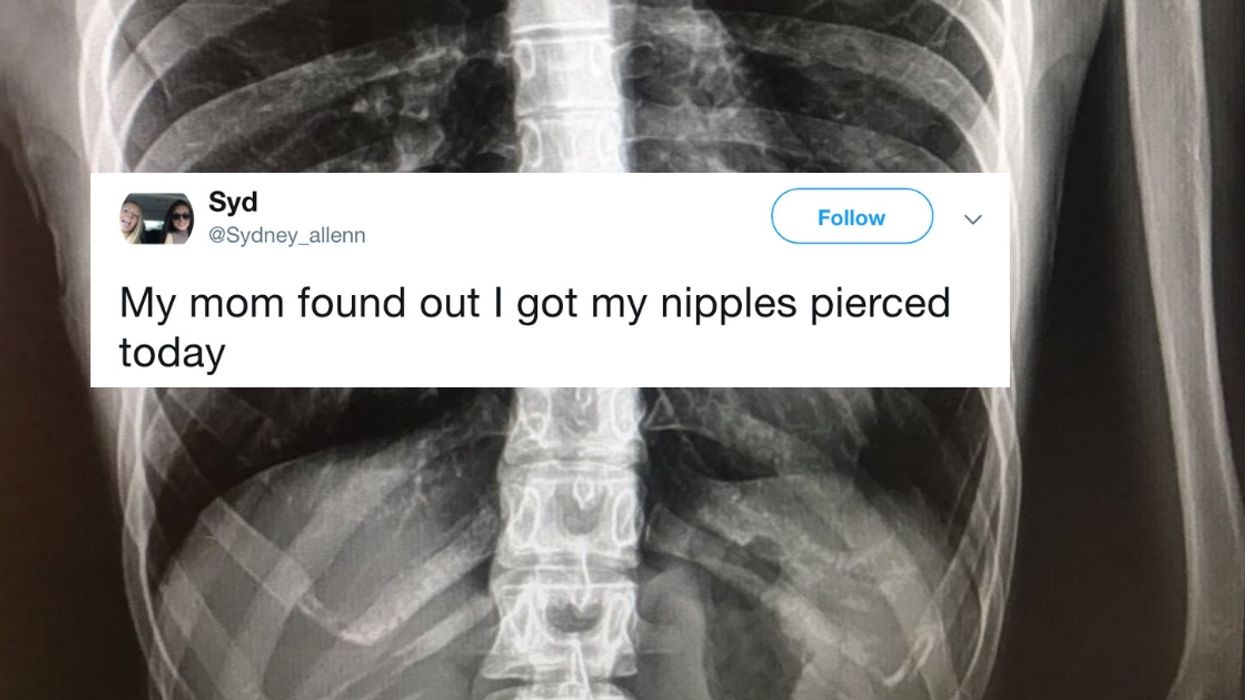 Woman's Mom Found Out She Got Her Nipples Pierced Thanks To A Very Telling X-Ray 😂