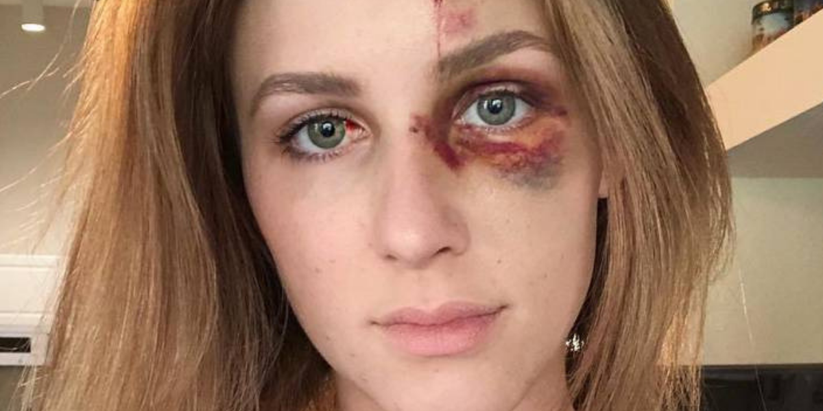 Woman's Message About Domestic Abuse Goes Viral When She Posts Pictures