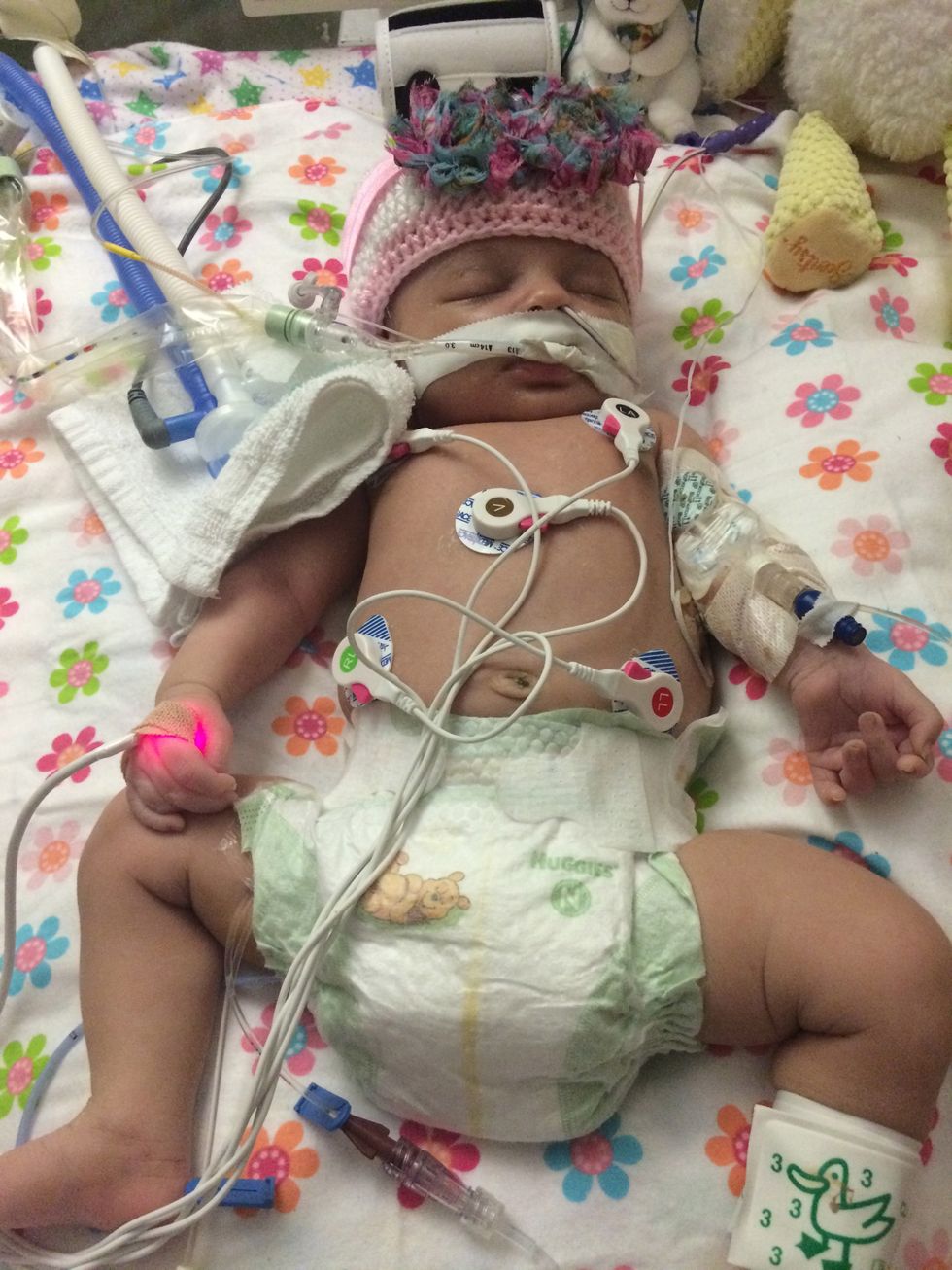 Doctors Said This Baby's Condition Was With Life,' but