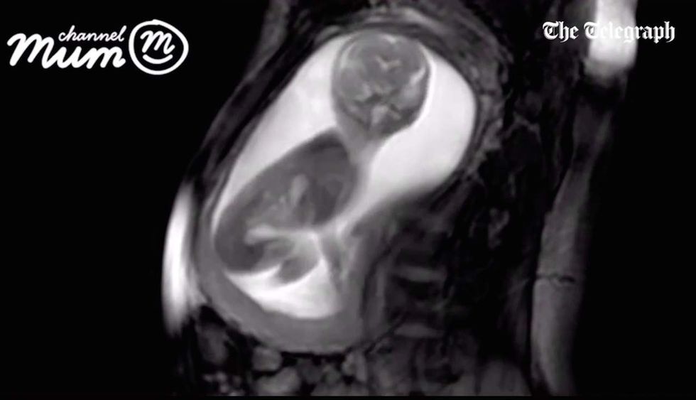 New Technology Captures Clear Footage Of An Unborn Baby In The Womb