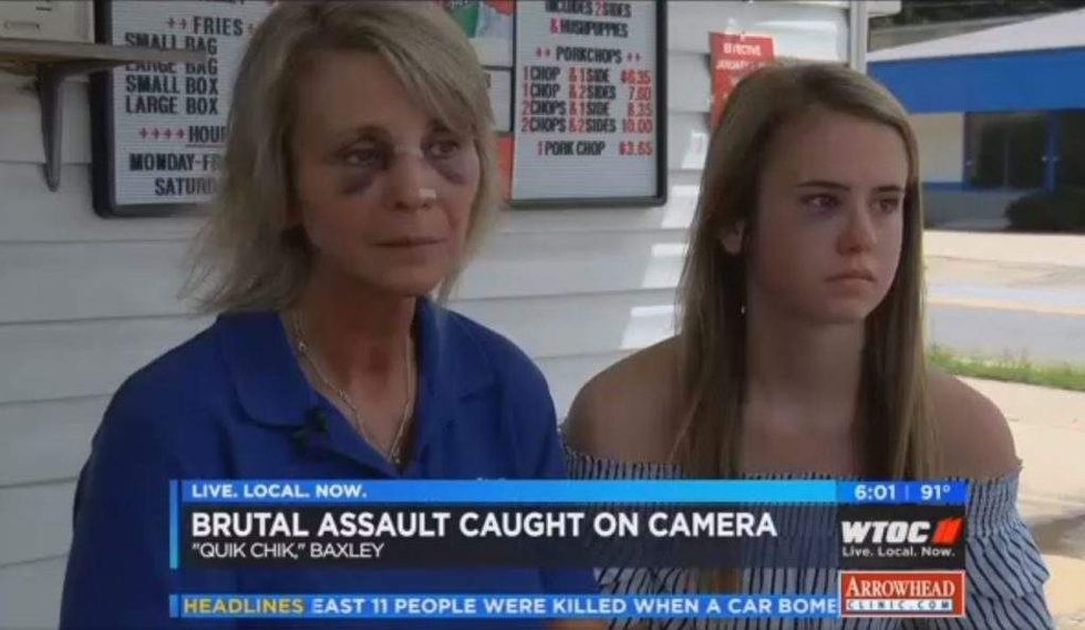 Pure brutality' Mom, teen daughter beaten up at their restaurant for