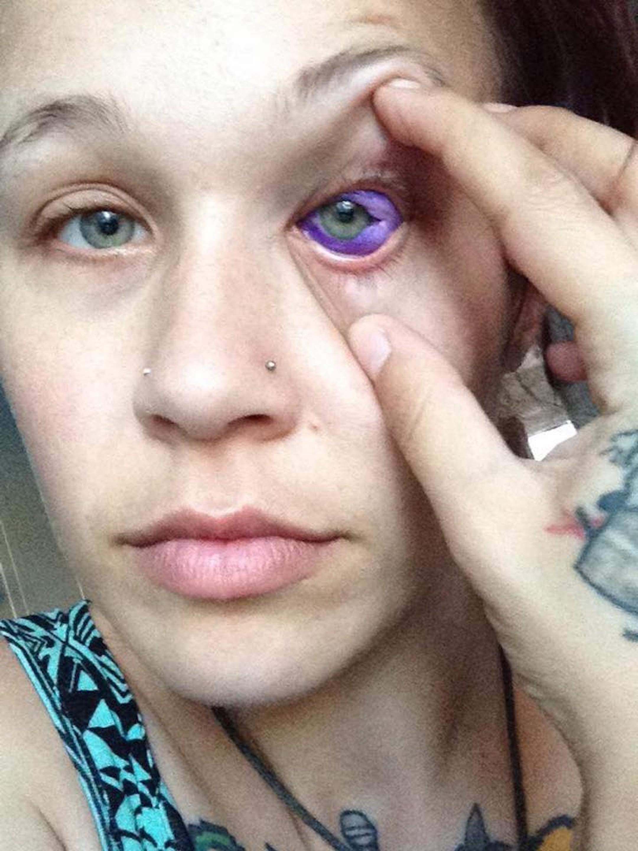 tattooed eyeballs