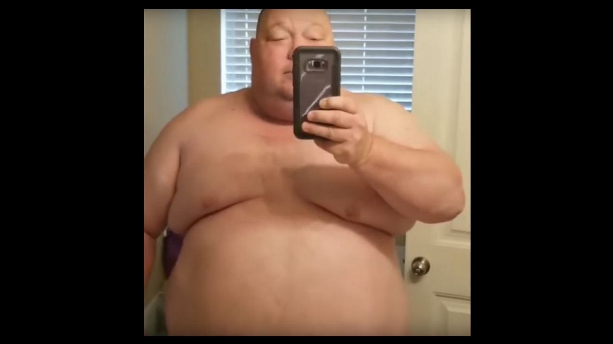 This Man Lost 198 lbs In One Year And Now He's Almost Unrecognizable