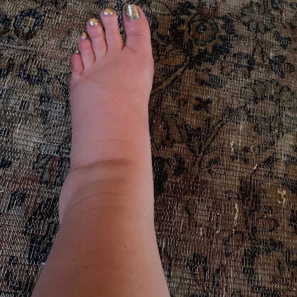 Jessica Simpson's Foot Should Host the Oscars