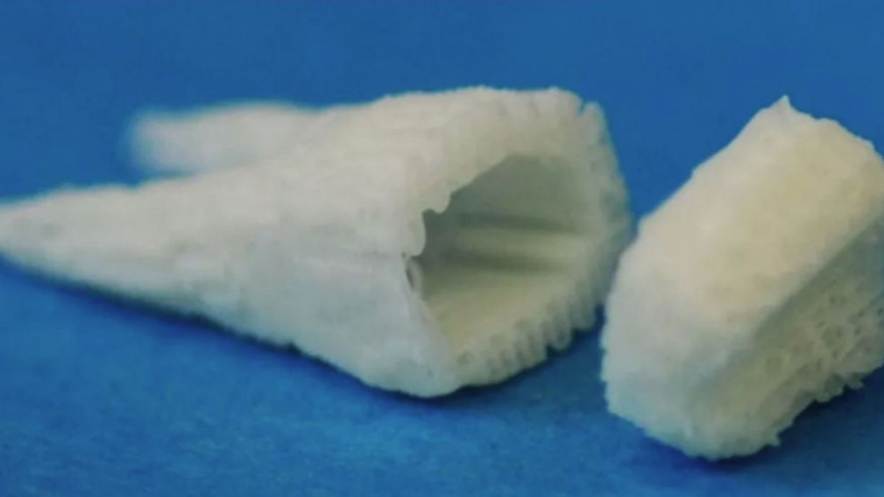 Stem Cell Dental Implants Offer Innovative Solution For People Who've Lost Their Teeth—And Quickly At That 😮