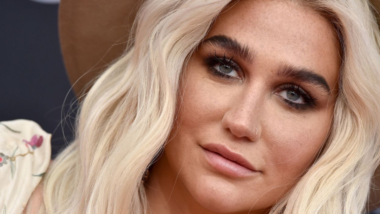 Kesha Is All About Self-Love With Makeup-Free Selfie Showing Off Her Freckles ❤️