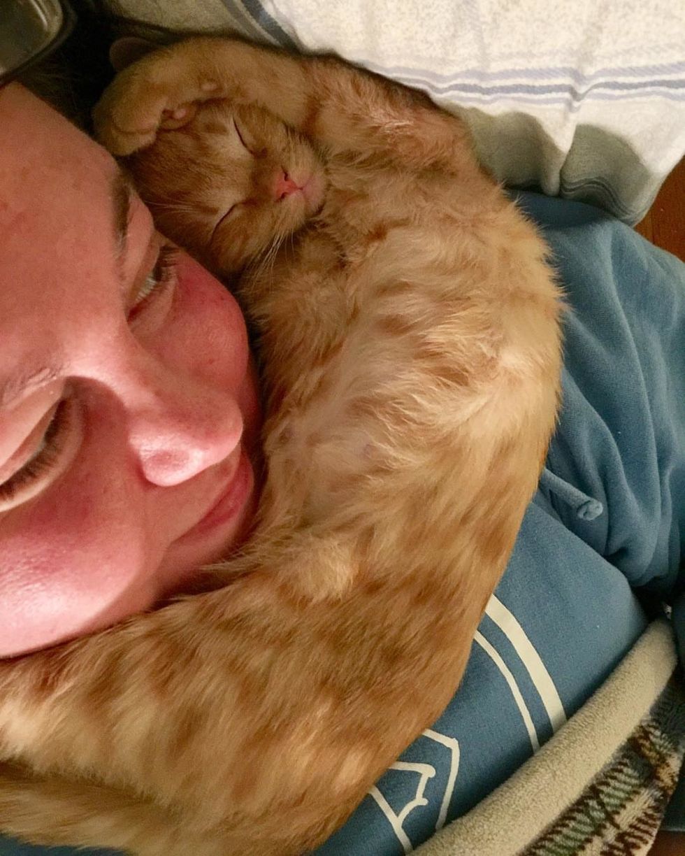 Kitten Born Special Cuddles Her Rescuer Every Day to Help Herself Heal