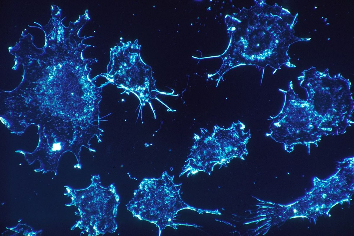 L’immunoterapia non va glorificata, può essere tossica e costa troppo
