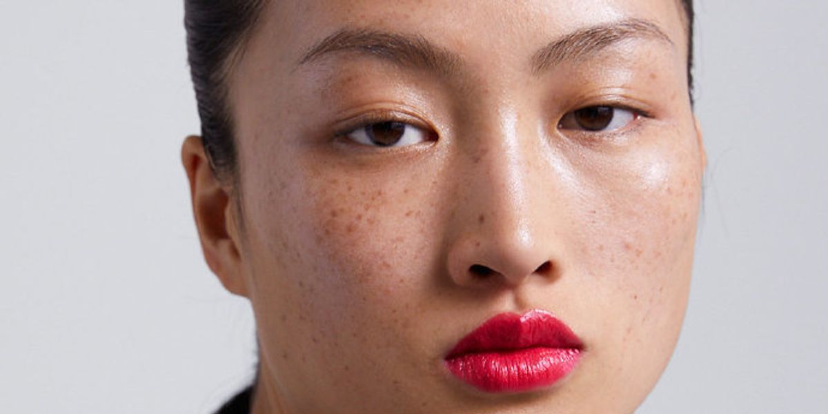 Zara Sparks Debate in China Over Model With Freckles - PAPER