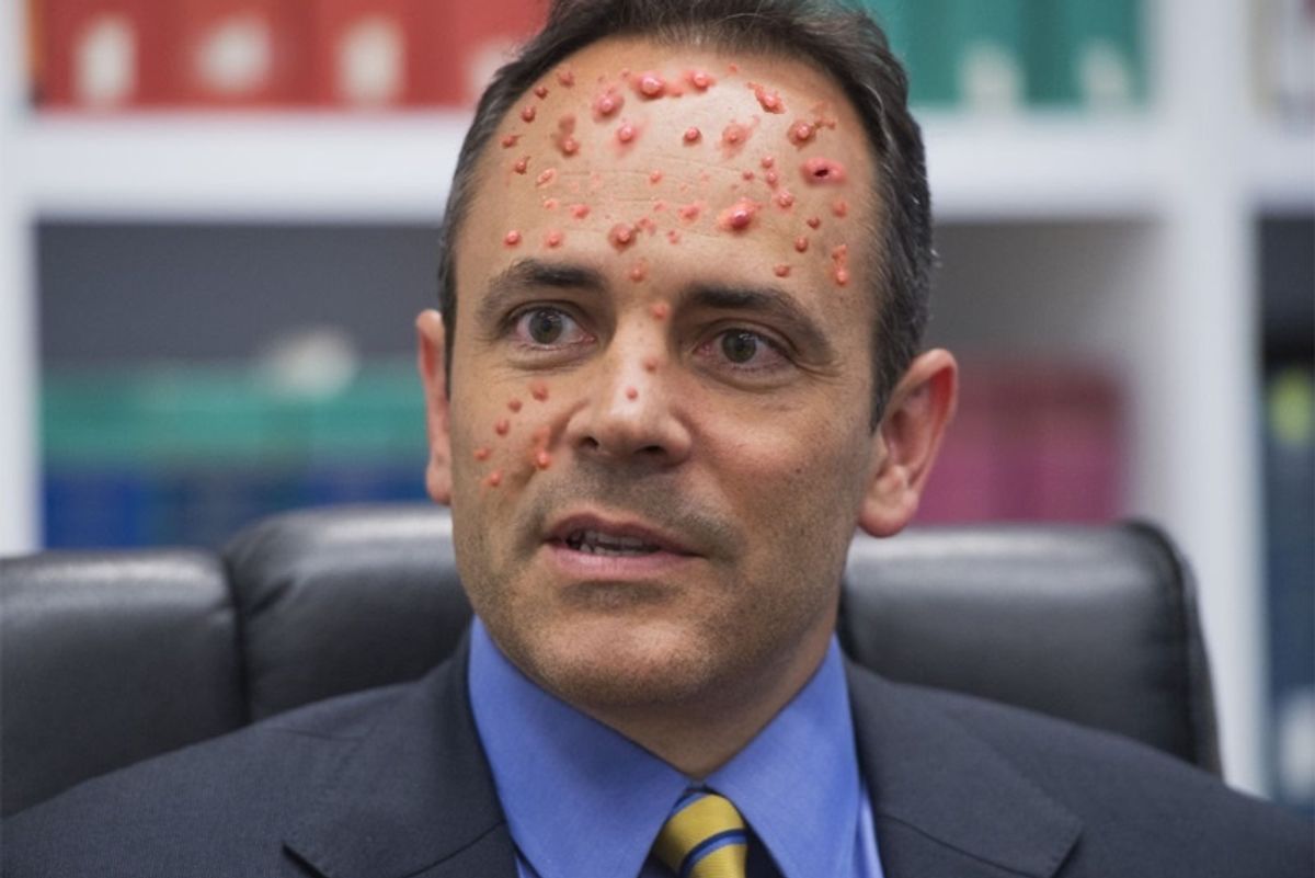 Kentucky Gov. Matt Bevin To Own Kids: 'A Pox Upon Thee!'