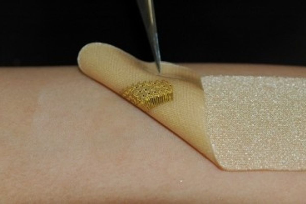 sensor wound healing skin