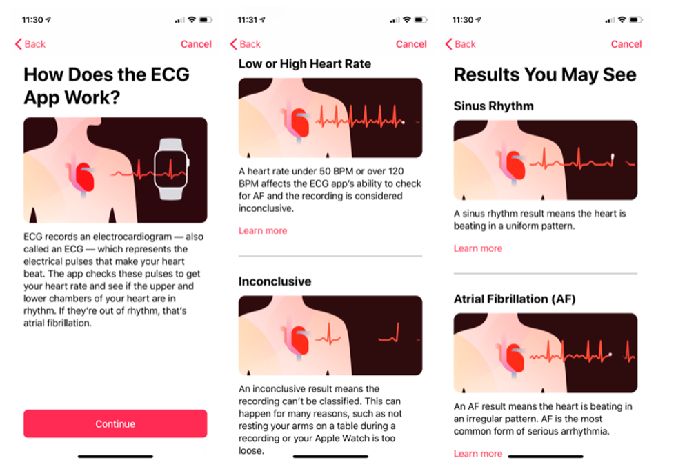 Screenshots of the ECG feature of the Apple Watch Series 4