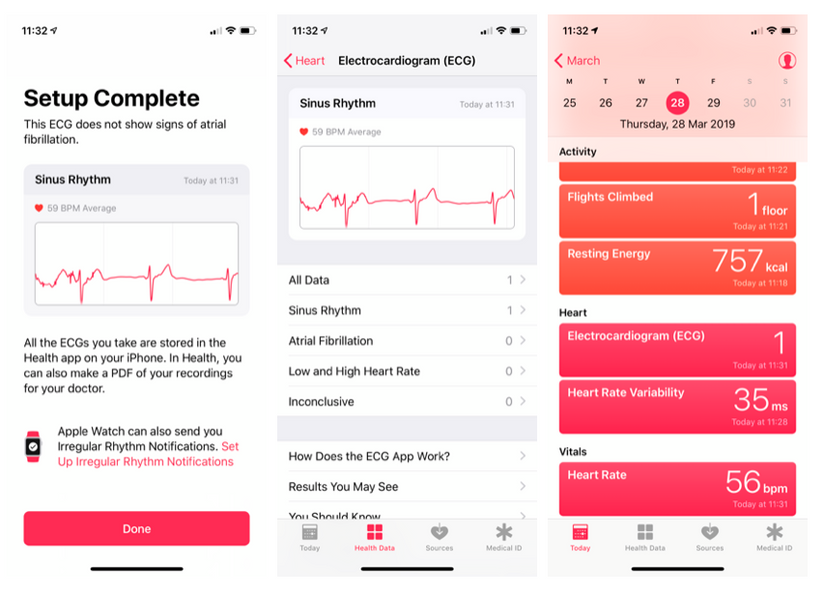 Apple Watch ECG app: What cardiologists want you to know - CNET