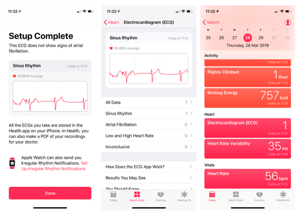 How the ECG feature of the Apple Watch Series 4 works - Gearbrain