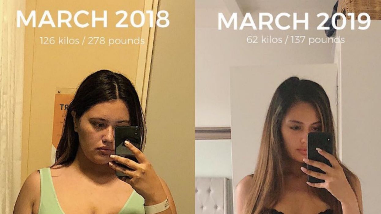 Woman Documents Her Incredible 141-Pound Weight Loss Journey On Social Media, And She Doesn't Sugarcoat Anything