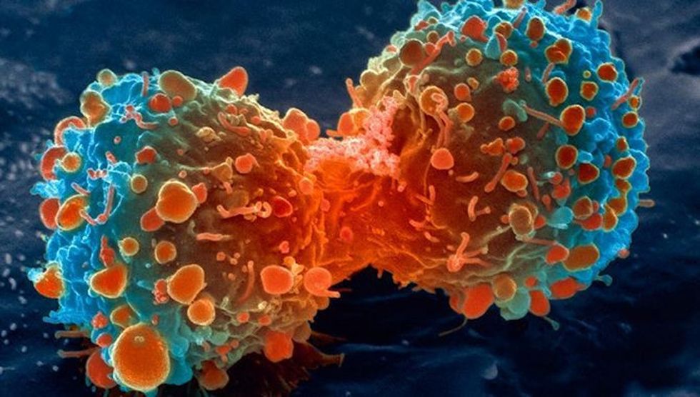 This chemotherapy-free treatment could be a breakthrough in the fight against cancer.