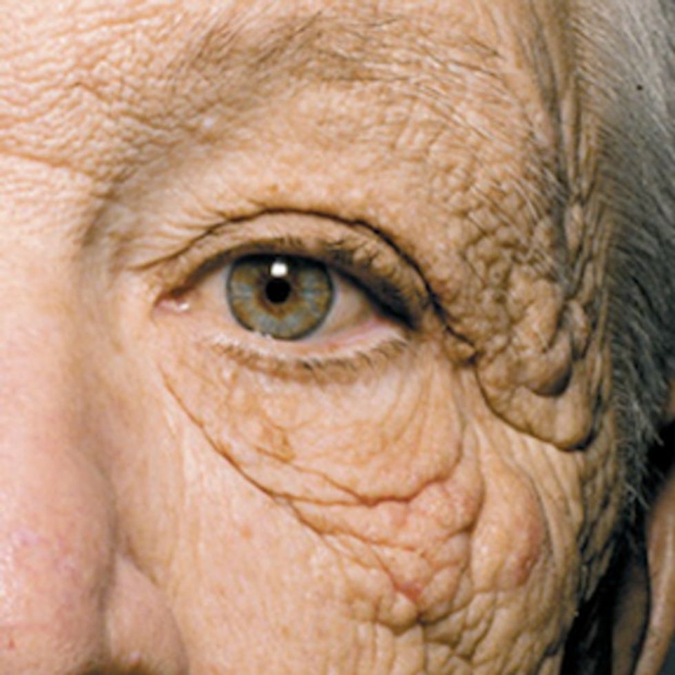 What does 28 years of sun damage look like? This.