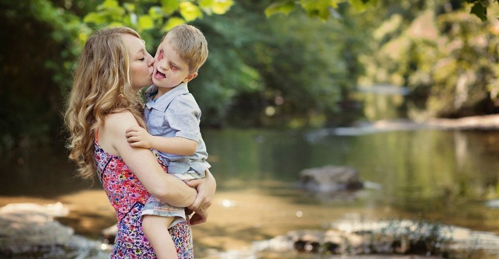 He Has One Of The World S Rarest Birth Defects Here S What The Experience Taught His Mom Upworthy