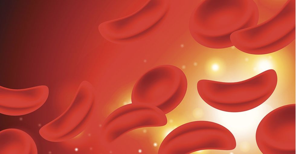 Game-changing genetic editing just let one teenager 'dodge' sickle cell disease.