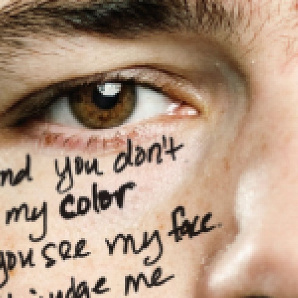 Why You're Lucky That You're White