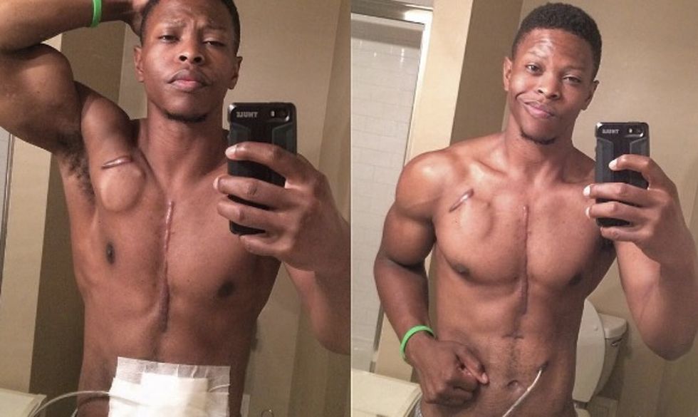 Meet the fitness model using his scars and artificial heart to inspire people.