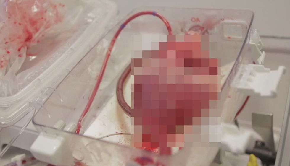It Looks Like Something You Should Never See. Meet A Medical Advancement That Is Hard To Forget.