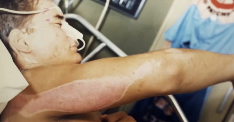 Watch One Man's Amazing Journey To Recovery, And Meet Those Who Helped Along The Way