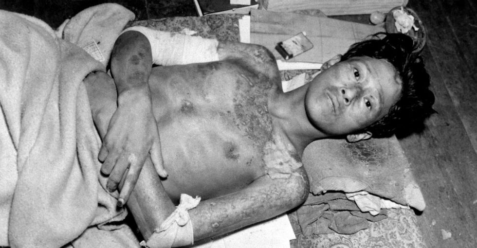 His DNA Was Shredded By 2 Atomic Bombs. So What Happened When He Had Kids?