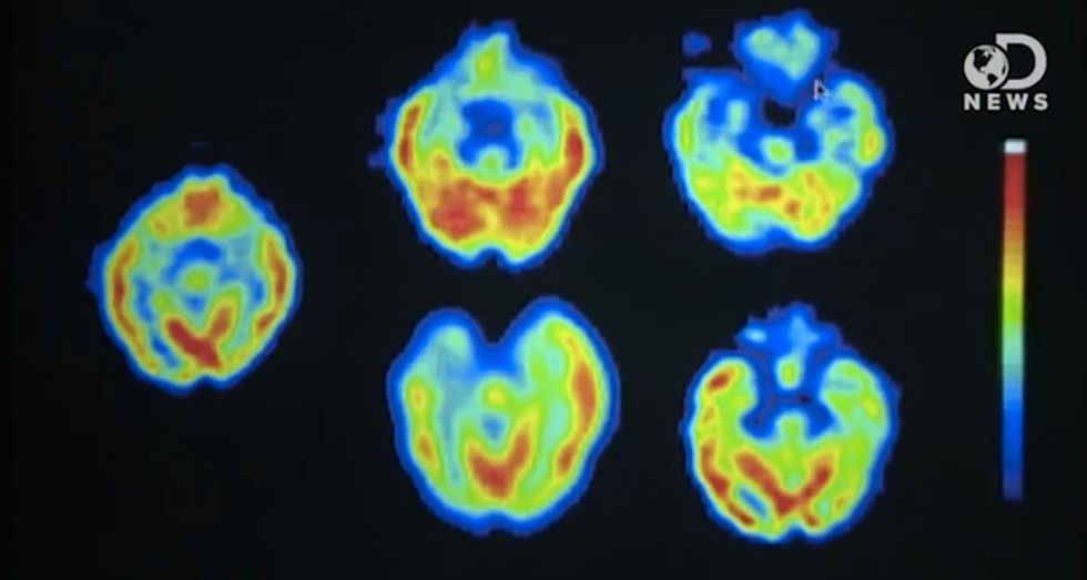 This Is Your Brain. This Is Your Brain On Fiction.