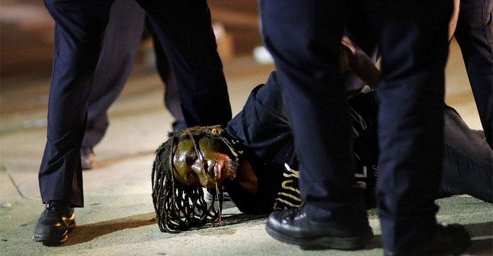 Don't understand #BlackLivesMatter? See how police treat white protesters.