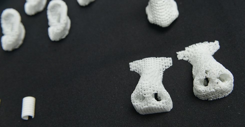 Kaiba was born with a deadly illness. A 3D-printed splint saved his life.