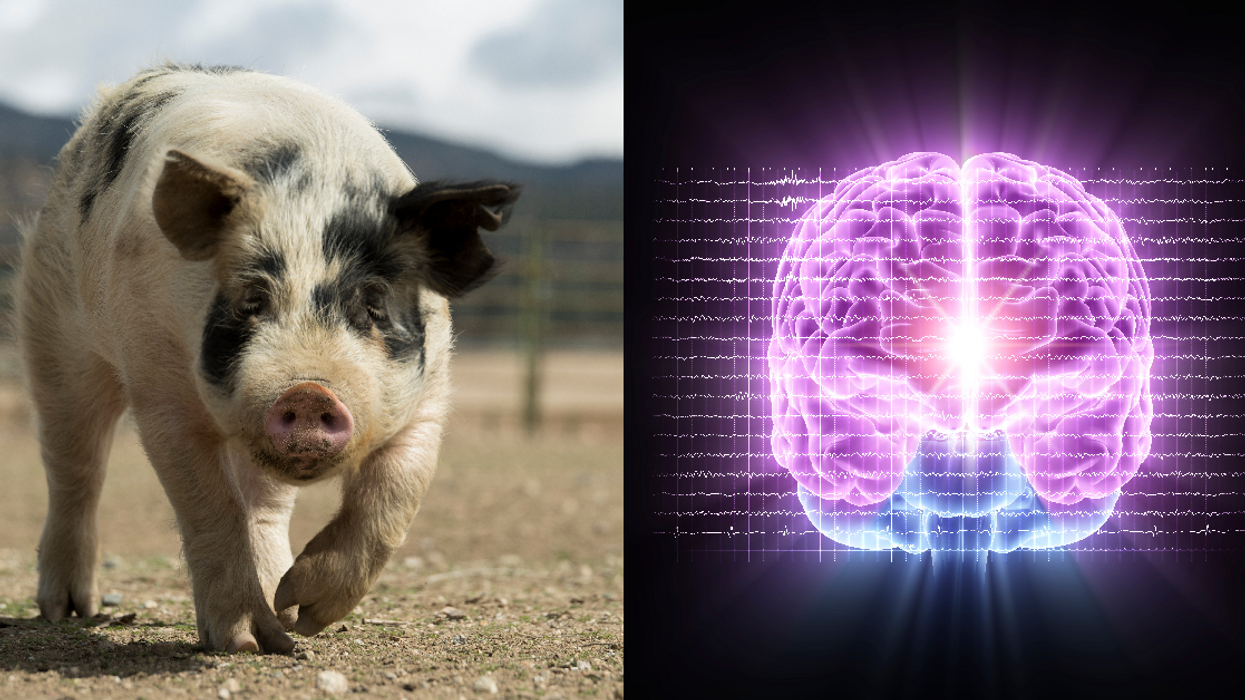 Scientists Have Restored A Surprising Amount Of Function In The Brain Of A Pig Hours After It Was Killed In A Slaughterhouse
