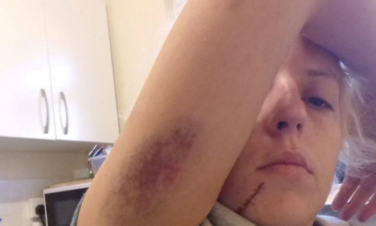 Mom Slams Judges After Neighbor Who Viciously Assaulted Her Is Spared Jail Time