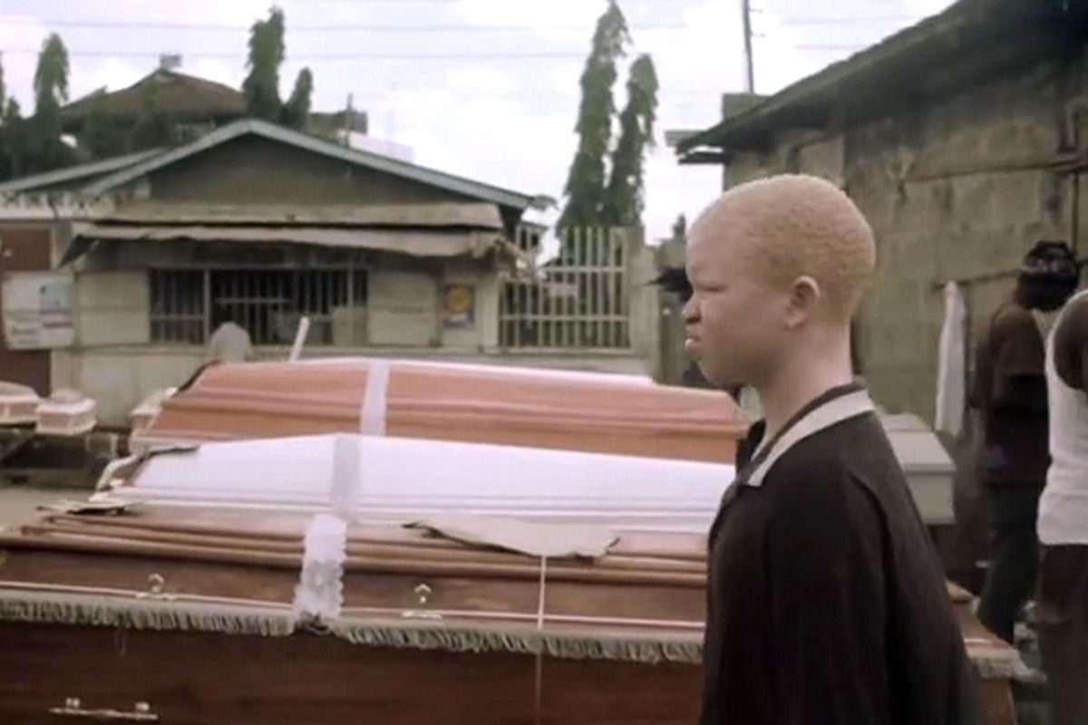 Sterminio degli albini cacciati in Africa perché «maledetti»