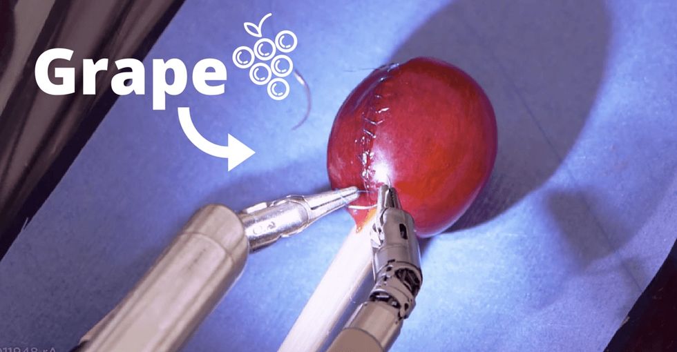 There are some really cool advances happening in the medical world. Here's one of them.