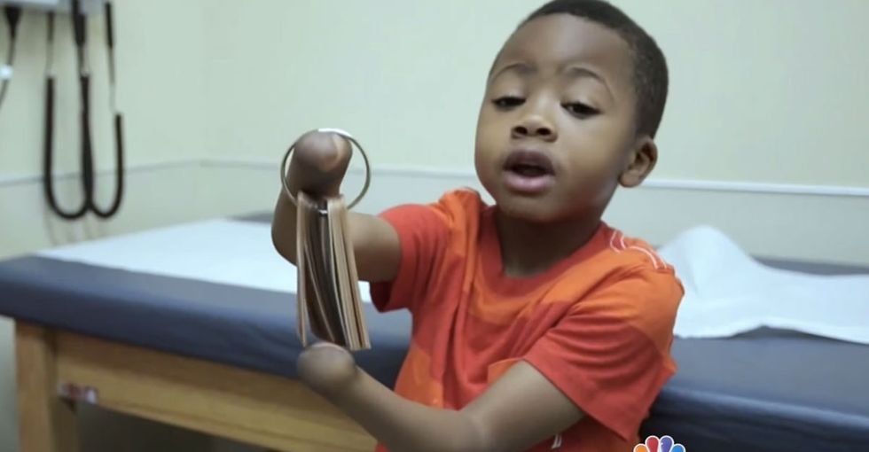 Meet the incredible 8-year-old who just got two brand-new REAL hands.