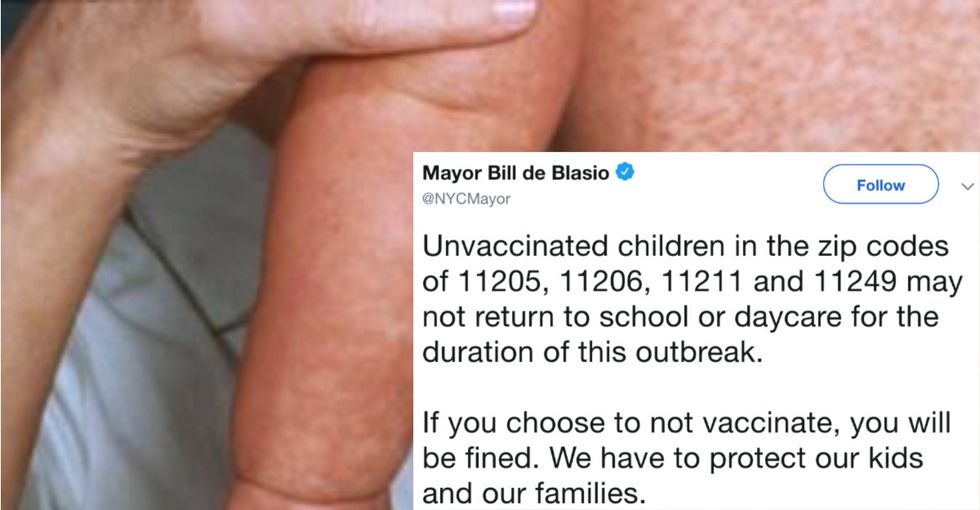 The measles outbreak has hit New York City. Literature targeting Orthodox Jews is behind it.