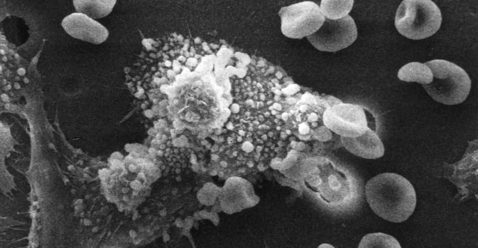 A chemical in wasp venom might kill cancer cells and leave healthy cells alone.