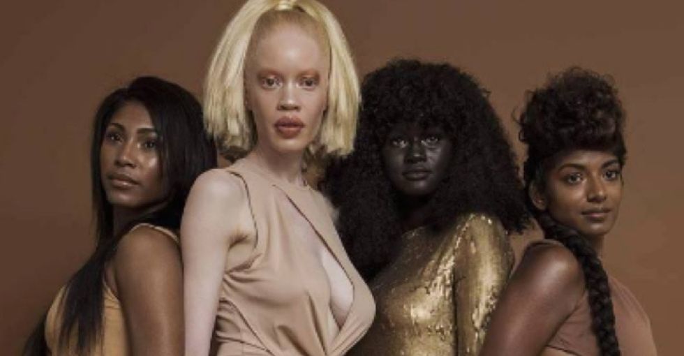 This model was bullied for her dark skin. Her story is all too familiar.