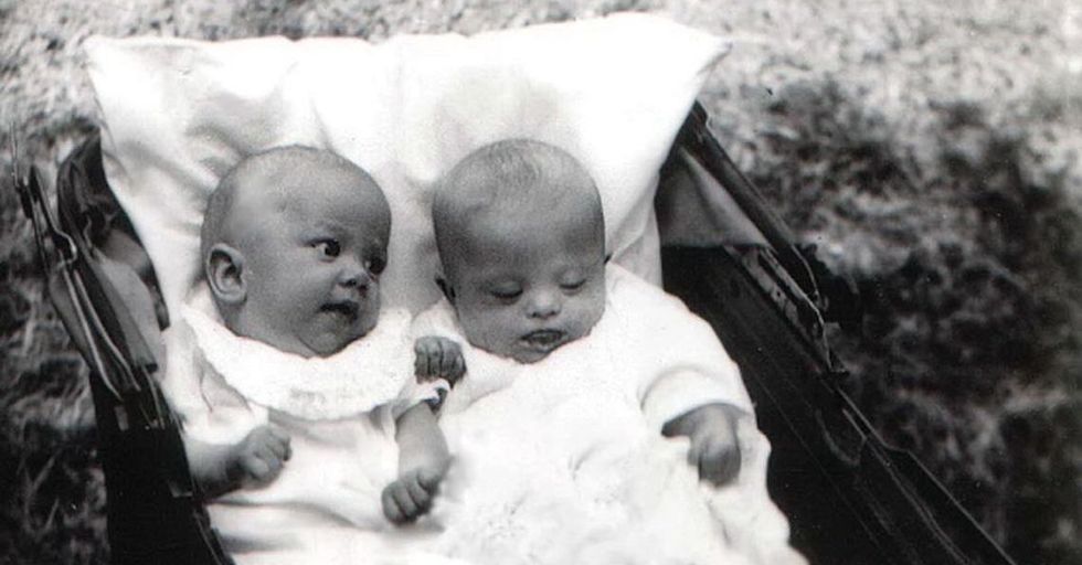 The moving story of Judith and Joyce Scott will make you believe in twin magic.