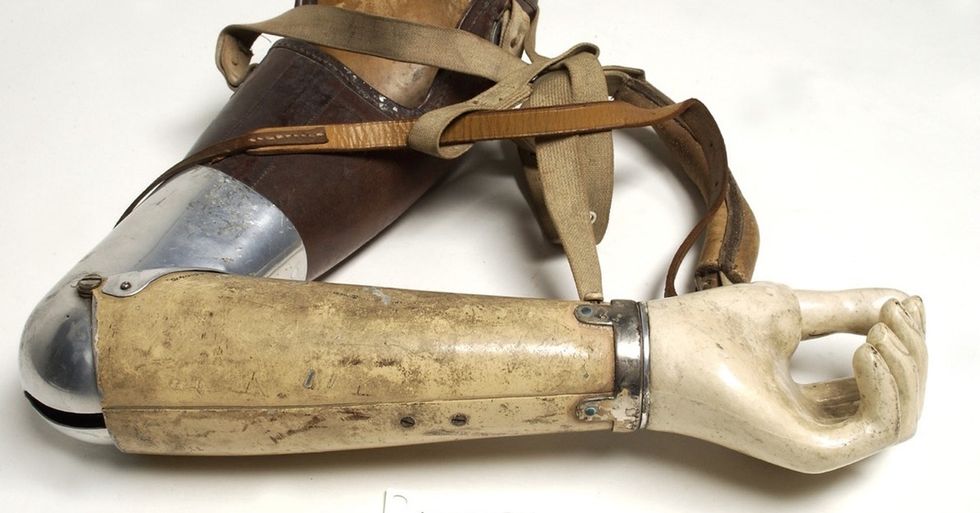 3 examples of what prosthetics used to be and a look into the future in motion.