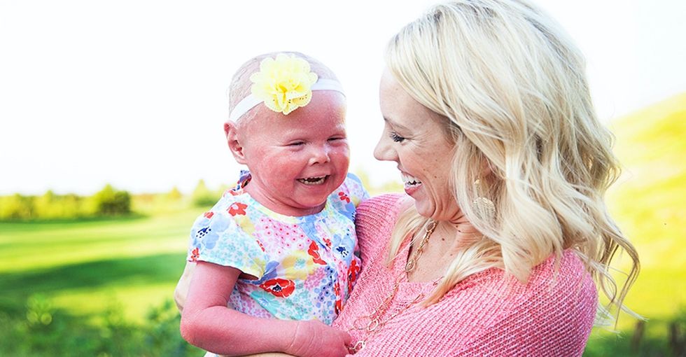 My daughter has a skin disorder. This is how I wish others would ask about it.